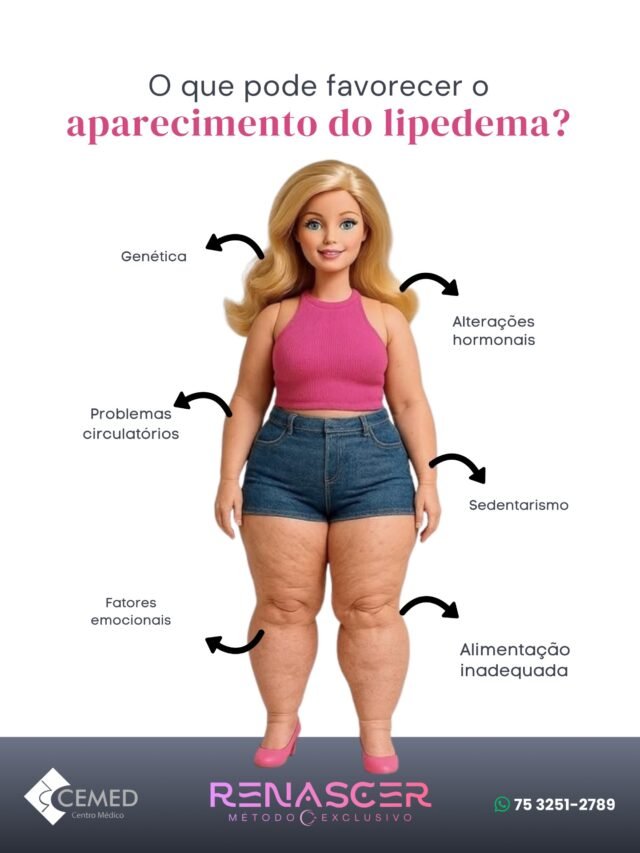 Você se identifica com os fatores que podem favorecer o lipedema, como genética, alterações hormonais ou problemas circulatórios? 🤔Entender essa condição é o primeiro passo para uma vida com mais qualidade e bem-estar. O lipedema não é apenas uma questão estética; é uma doença crônica que exige expertise médica e um tratamento personalizado.Na @clinica.cmais, a Dra. Rhafaelly Neves (Ginecologista, CRM 24216 | RQE 21058), uma autoridade reconhecida no manejo da saúde feminina e criadora do Método Renascer C+, oferece a condução integrativa e cientificamente embasado para o tratamento do lipedema.Nosso compromisso é com a sua saúde e a sua vida, proporcionando soluções que realmente fazem a diferença.Com o Método Renascer C+, você encontra um caminho para:• Reduzir a dor e o inchaço.• Melhorar a circulação e a drenagem linfática.• Equilibrar os fatores hormonais e metabólicos.• Recuperar a autoestima e a qualidade de vida.Não adie o cuidado com a sua saúde. Busque um diagnóstico preciso e um plano de tratamento eficaz.Para pacientes em Feira de Santana e Itaberaba, a @clinica.cmais é o seu destino para um tratamento de lipedema com confiança e resultados comprovados.Agende sua consulta hoje mesmo!
Clique no link da bio ou entre em contato via WhatsApp: (75) 3251-2789. Sua jornada para Renascer começa aqui! ✨_#Lipedema #TratamentoLipedema #DraRhafaellyNeves #MetodoRenascer #