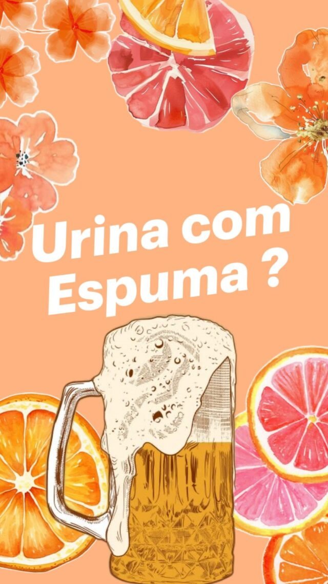 A animação é curiosa, mas o assunto é fundamental para a sua saúde!🤔 Você sabe diferenciar uma espuma “normal” de uma que exige atenção médica?A espuma causada apenas pela força do jato costuma sumir em poucos segundos. Já a espuma que parece “clara de ovo” e permanece no vaso pode ser o primeiro sinal de que seus rins estão sobrecarregados.Quando ligar o sinal de alerta?1️⃣ Se a espuma for frequente em todas as idas ao banheiro;2️⃣ Se notar inchaço nos pés, mãos ou ao redor dos olhos;3️⃣ Se a cor da urina estiver muito escura (cor de chá ou refrigerante de cola).A prevenção é o melhor tratamento. Seus rins trabalham 24h por dia para filtrar seu corpo, dê a eles a atenção que merecem! 💧Agende seu check-up com facilidade:💬 Nossa central de atendimento espera por você no WhatsApp: (75) 3251-2789_
#tratourinario
#urology #urologia
#urologyproblems