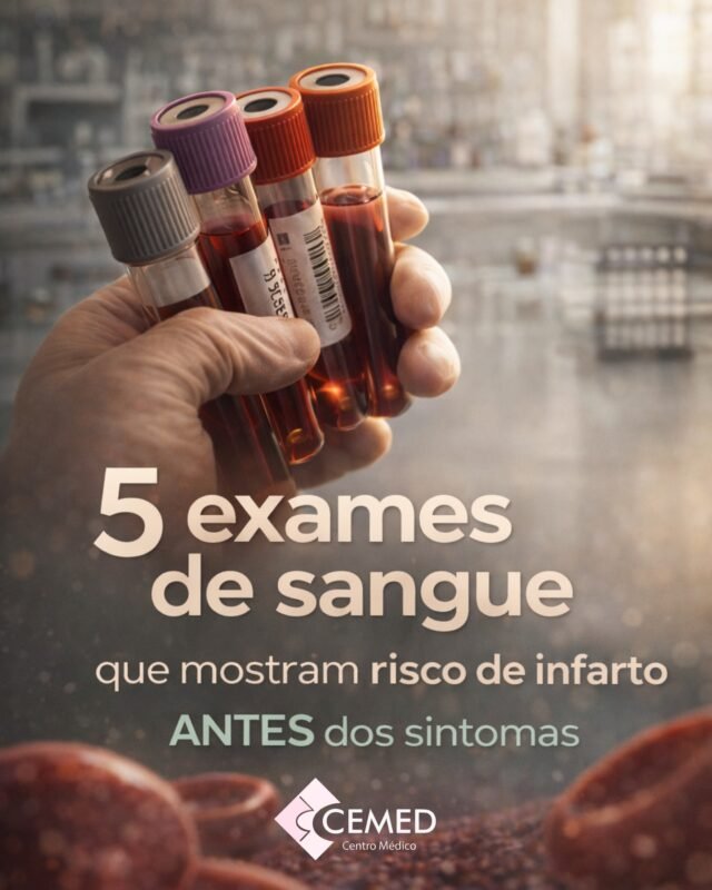 Infarto não acontece de repente.‼️Ele se desenvolve silenciosamente ao longo do tempo.Alguns exames laboratoriais ajudam o médico a identificar fatores de risco cardiovascular antes mesmo dos sintomas aparecerem.Neste carrossel mostramos 5 exames que podem complementar a avaliação clínica:• Homocisteína
• PCR-us
• Insulina de jejum
• Lipoproteína (a)
• ApoBEles não substituem consulta médica, mas fornecem informações importantes para uma análise mais completa do seu perfil metabólico e cardiovascular.Quanto antes o risco é identificado, maiores são as chances de prevenção.Aqui você encontra exames acessíveis, realizados com qualidade técnica, precisão e responsabilidade.Se faz tempo que você não revisa seus exames, este é um bom momento para cuidar da sua saúde.Agende seus exames via nossa central de atendimento no WhatsApp: 🟢 (75) 3251-2789Prevenção é decisão.____
#itaberaba
#fsa #chapadadiamantina
#reconcavo #exameslaboratóriais